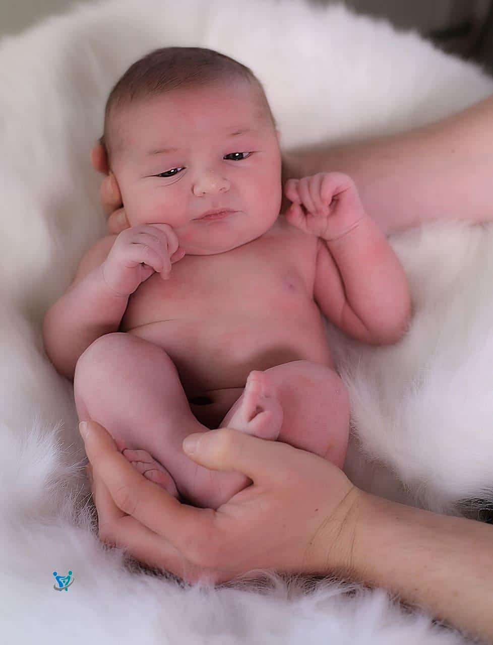 قلة التبرز عند حديثي الولادة 1 قلة التبرز عند حديثي الولادة